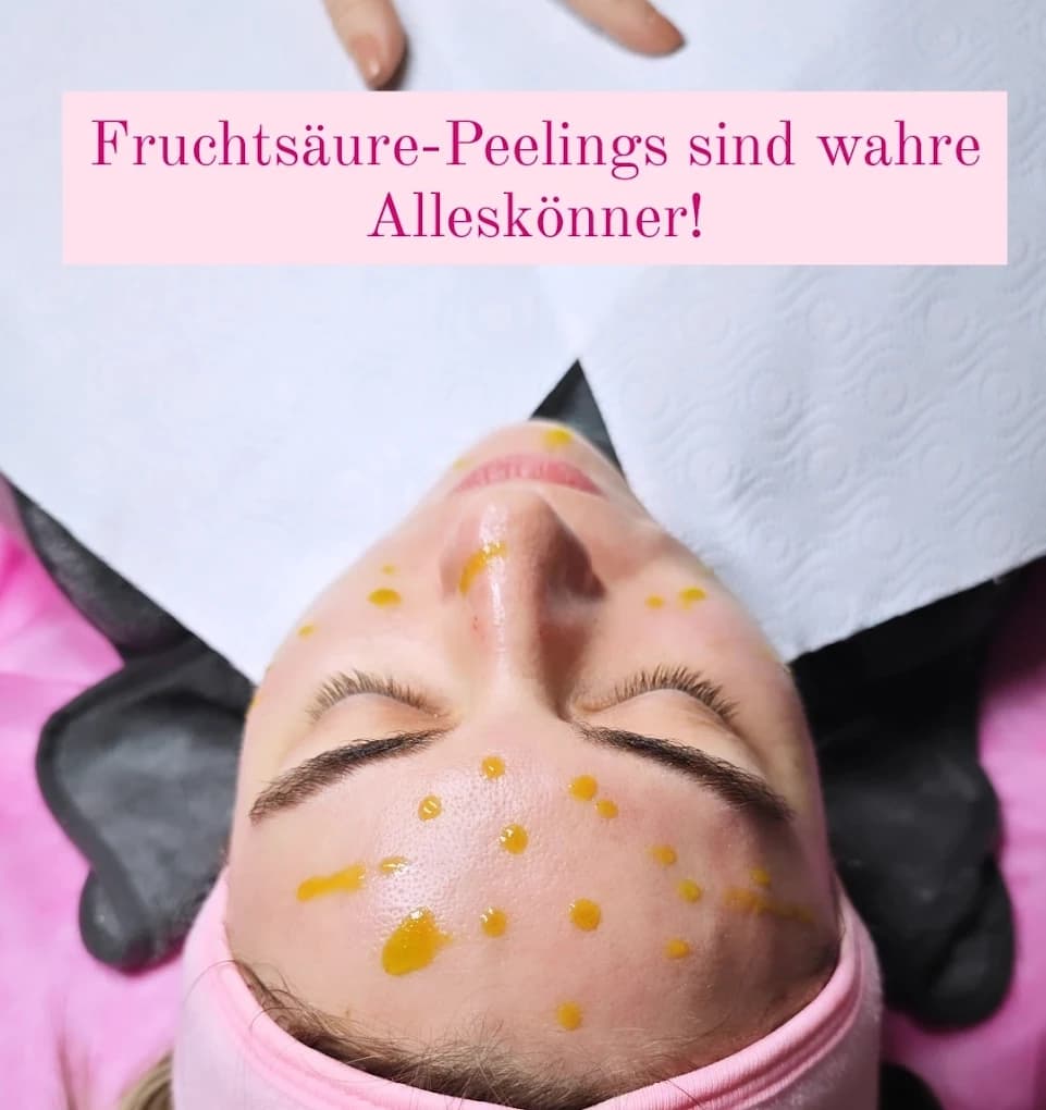 Fruchtsäure Peeling - Zaira Beauty