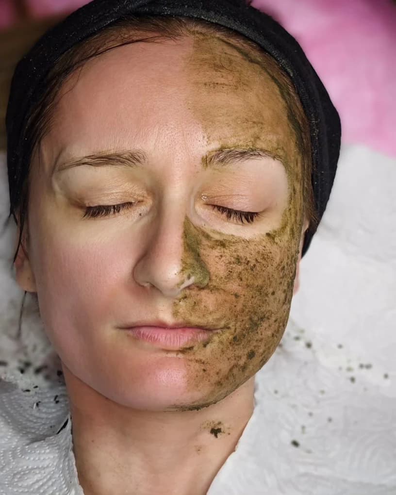 Peeling Behandlung - Zaira Beauty